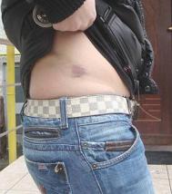 Student agresat la Sectia de psihiatrie